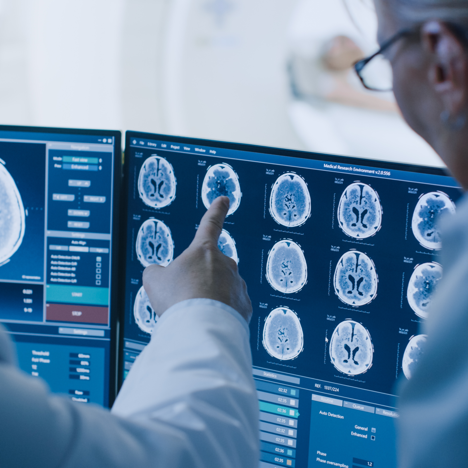 photo of pointing to brain scans